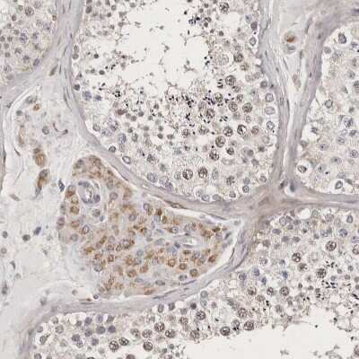Immunohistochemistry-Paraffin MRPS10 Antibody - BSA Free