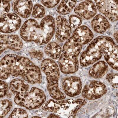 Immunohistochemistry-Paraffin MRPS10 Antibody - BSA Free
