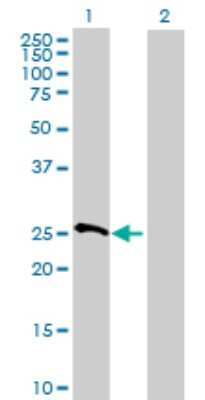 Western Blot: MRPS10 Antibody [H00055173-B01P] - Analysis of MRPS10 expression in transfected 293T cell line by MRPS10 polyclonal antibody.  Lane 1: MRPS10 transfected lysate(22.22 KDa). Lane 2: Non-transfected lysate.