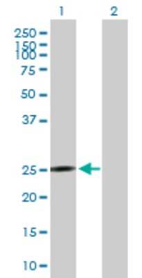 Western Blot: MRPS10 Antibody [H00055173-B02P] - Analysis of MRPS10 expression in transfected 293T cell line by MRPS10 polyclonal antibody.  Lane 1: MRPS10 transfected lysate(22.11 KDa). Lane 2: Non-transfected lysate.