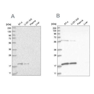 Western Blot MRPS10 Antibody - BSA Free
