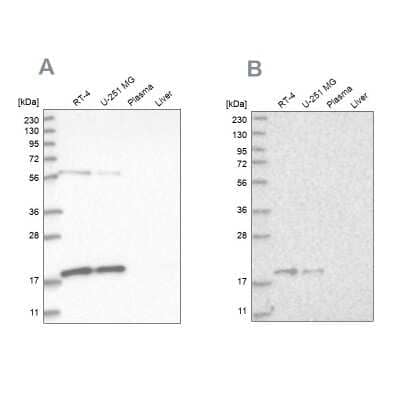 Western Blot MRPS10 Antibody - BSA Free