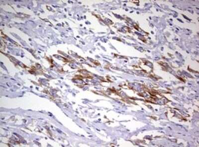 Immunohistochemistry MRPS11 Antibody (OTI2E9)