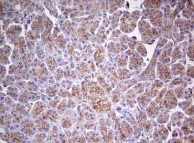 Immunohistochemistry MRPS11 Antibody (OTI2E9)