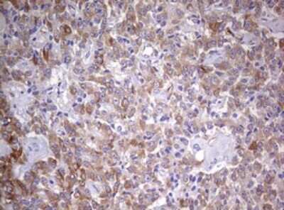 Immunohistochemistry MRPS11 Antibody (OTI2E9)