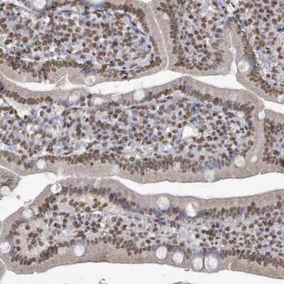 Immunohistochemistry-Paraffin: MRPS12 Antibody [NBP2-13621] - Staining of human duodenum shows nuclear positivity in glandular cells.