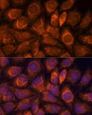 Immunocytochemistry/Immunofluorescence: MRPS14 Antibody [NBP2-93952] - Analysis of HeLa cells using MRPS14 at dilution of 1:100. Blue: DAPI for nuclear staining.