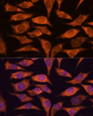 Immunocytochemistry/Immunofluorescence: MRPS14 Antibody [NBP2-93952] - Analysis of L929 cells using MRPS14 at dilution of 1:100. Blue: DAPI for nuclear staining.