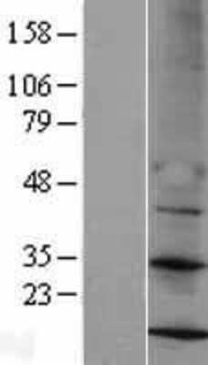 Western Blot: MRPS14 Overexpression Lysate (Adult Normal) [NBL1-13286] Left-Empty vector transfected control cell lysate (HEK293 cell lysate); Right -Over-expression Lysate for MRPS14.