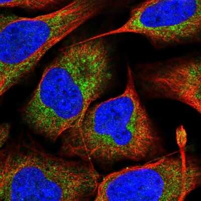 Immunocytochemistry/ Immunofluorescence MRPS16 Antibody