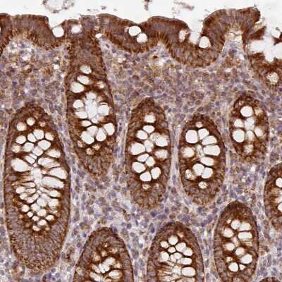 Immunohistochemistry-Paraffin MRPS16 Antibody