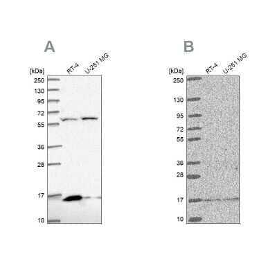 Western Blot MRPS16 Antibody