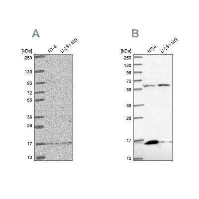 Western Blot: MRPS16 Antibody [NBP2-33721] - Analysis using Anti-MRPS16 antibody NBP2-33721 (A) shows similar pattern to independent antibody NBP2-33587 (B).