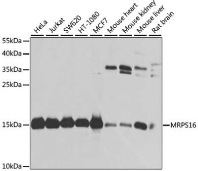 Western Blot: MRPS16 Antibody [NBP2-94082] - Analysis of extracts of various cell lines, using MRPS16 at 1:1000 dilution.Secondary antibody: HRP Goat Anti-Rabbit IgG (H+L) at 1:10000 dilution.Lysates/proteins: 25ug per lane.Blocking buffer: 3% nonfat dry milk in TBST.Detection: ECL Basic Kit .Exposure time: 10s.