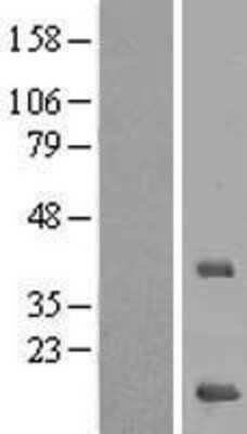 Western Blot: MRPS16 Overexpression Lysate (Adult Normal) [NBL1-13288] Left-Empty vector transfected control cell lysate (HEK293 cell lysate); Right -Over-expression Lysate for MRPS16.