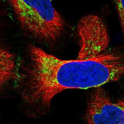 Immunocytochemistry/Immunofluorescence: MRPS18B Antibody [NBP2-48792] - Staining of human cell line U-2 OS shows localization to mitochondria & cell junctions.