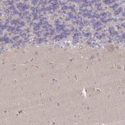 Immunohistochemistry-Paraffin: MRPS18B Antibody [NBP2-48958] - Staining of human cerebellum shows weak cytoplasmic positivity in Purkinje cells, cells in molecular layer and granular layer).