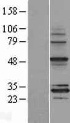 Western Blot: MRPS18B Overexpression Lysate (Adult Normal) [NBL1-13289] Left-Empty vector transfected control cell lysate (HEK293 cell lysate); Right -Over-expression Lysate for MRPS18B.