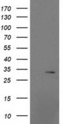 Western Blot: MRPS2 Antibody (4D6) [NBP2-03292] - HEK293T cells were transfected with the pCMV6-ENTRY control (Left lane) or pCMV6-ENTRY MRPS2 (Right lane) cDNA for 48 hrs and lysed. Equivalent amounts of cell lysates (5 ug per lane) were separated by SDS-PAGE and immunoblotted with anti-MRPS2.