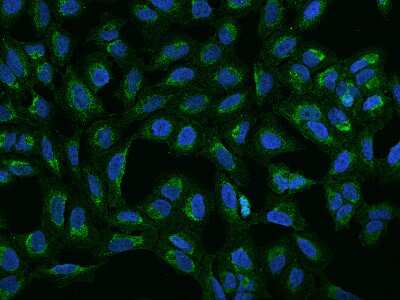 Immunocytochemistry/Immunofluorescence: MRPS2 Antibody [NBP3-06045] - Immunofluorescence staining of MRPS2 in U2OS cells. Cells were fixed with 4% PFA, permeabilzed with 0.1% Triton X-100 in PBS,blocked with 10% serum, and incubated with rabbit anti-Human MRPS2 polyclonal antibody (dilution ratio 1:200) at 4C overnight. Then cells were stained with the Alexa Fluor(R)488-conjugated Goat Anti-rabbit IgG secondary antibody (green) and counterstained with DAPI (blue).Positive staining was localized to Cytoplasm.