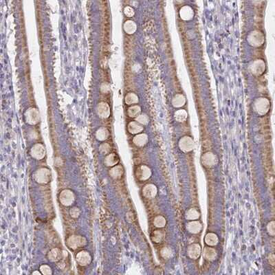 Immunohistochemistry-Paraffin: MRPS2 Antibody [NBP2-33822] - Staining of human duodenum shows moderate cytoplasmic positivity in glandular cells.