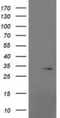 Western Blot: MRPS2 Antibody (OTI4D6) - Azide and BSA Free [NBP2-72783] - HEK293T cells were transfected with the pCMV6-ENTRY control (Left lane) or pCMV6-ENTRY MRPS2 (Right lane) cDNA for 48 hrs and lysed. Equivalent amounts of cell lysates (5 ug per lane) were separated by SDS-PAGE and immunoblotted with anti-MRPS2.