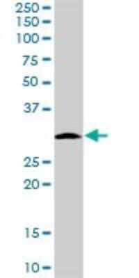 Western Blot: MRPS2 Antibody [H00051116-B01P] - Analysis of MRPS2 expression in A-431.