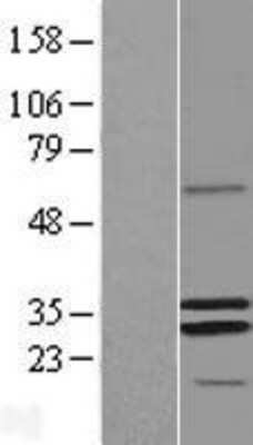 Western Blot: MRPS2 Overexpression Lysate (Adult Normal) [NBL1-13291] Left-Empty vector transfected control cell lysate (HEK293 cell lysate); Right -Over-expression Lysate for MRPS2.