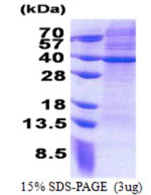 SDS-Page: MRPS2 Protein [NBP2-23242]