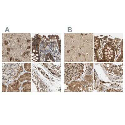 Immunohistochemistry-Paraffin MRPS22 Antibody