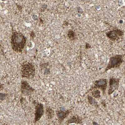 Immunohistochemistry-Paraffin MRPS22 Antibody