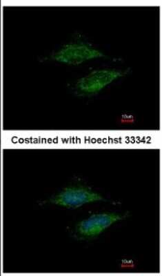 Immunocytochemistry/Immunofluorescence: MRPS23 Antibody [NBP2-19411] - Immunofluorescence analysis of methanol-fixed HeLa, using antibody at 1:500 dilution.