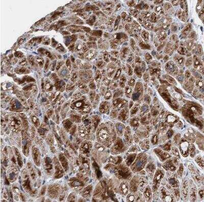 Immunohistochemistry-Paraffin MRPS23 Antibody - BSA Free