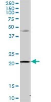 Western Blot: MRPS23 Antibody [H00051649-B01P] - Analysis of MRPS23 expression in HeLa.