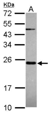Western Blot: MRPS23 Antibody [NBP2-19410] - Sample (30 ug of whole cell lysate) A: HepG2 12% SDS PAGE gel, diluted at 1:1000.