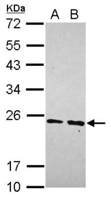 Western Blot: MRPS23 Antibody [NBP2-19411] - Sample (30 ug of whole cell lysate) A: Hela B: Hep G2 12% SDS PAGE gel, diluted at 1:1000.
