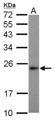 Western Blot: MRPS23 Antibody [NBP2-19412] - Sample (30 ug of whole cell lysate) A: HepG2 12% SDS PAGE gel, diluted at 1:1000.