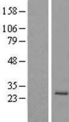 Western Blot: MRPS23 Overexpression Lysate (Adult Normal) [NBL1-13294] Left-Empty vector transfected control cell lysate (HEK293 cell lysate); Right -Over-expression Lysate for MRPS23.