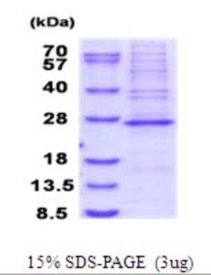 SDS-Page: MRPS23 Recombinant Protein [NBP2-51871] - 15% SDS Page (3 ug)