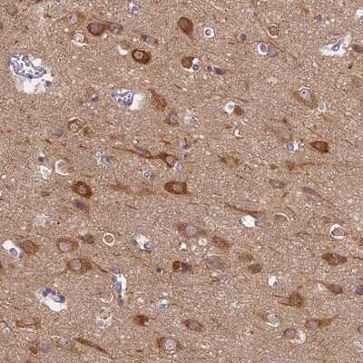 Immunohistochemistry-Paraffin: MRPS25 Antibody [NBP1-85151] - Staining of human cerebral cortex shows strong cytoplasmic positivity in neurons.