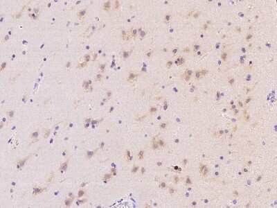 Immunohistochemistry-Paraffin: MRPS25 Antibody [NBP2-98523] - Immunochemical staining of human MRPS25 in human brain with rabbit polyclonal antibody at 1:2000 dilution, formalin-fixed paraffin embedded sections.