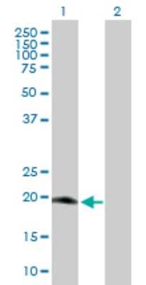 Western Blot: MRPS25 Antibody [H00064432-B01P] - Analysis of MRPS25 expression in transfected 293T cell line by MRPS25 polyclonal antibody.  Lane 1: MRPS25 transfected lysate(19.03 KDa). Lane 2: Non-transfected lysate.