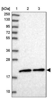 Western Blot: MRPS25 Antibody [NBP1-85151] - Lane 1: Marker  [kDa] 250, 130, 95, 72, 55, 36, 28, 17, 10.  Lane 2: Human cell line RT-4.  Lane 3: Human cell line U-251MG sp