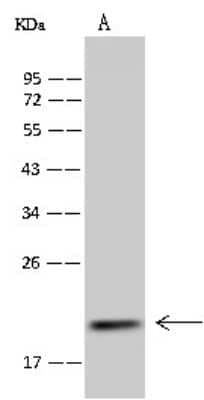 Western Blot: MRPS25 Antibody [NBP2-98523] - Anti-MRPS25 rabbit polyclonal antibody at 1:500 dilution. Lane A: MCF7 Whole Cell Lysate Lysates/proteins at 30 ug per lane. Secondary Goat Anti-Rabbit IgG (H+L)/HRP at 1/10000 dilution. Developed using the ECL technique. Performed under reducing conditions. Predicted band size: 20 kDa. Observed band size: 20 kDa