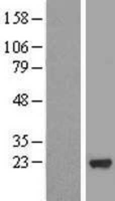 Western Blot: MRPS25 Overexpression Lysate (Adult Normal) [NBL1-13296] Left-Empty vector transfected control cell lysate (HEK293 cell lysate); Right -Over-expression Lysate for MRPS25.