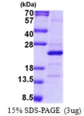 SDS-Page: MRPS25 Protein [NBP2-23243]