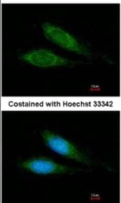 Immunocytochemistry/Immunofluorescence: MRPS27 Antibody [NBP2-19414] - Analysis of methanol-fixed HeLa, using antibody at 1:200 dilution.