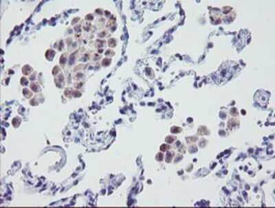 Immunohistochemistry: MRPS27 Antibody (OTI1A2) - Azide and BSA Free [NBP2-72784] - Staining of paraffin-embedded Human lung tissue using anti-MRPS27 mouse monoclonal antibody.