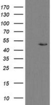 Western Blot: MRPS27 Antibody (OTI1A2) - Azide and BSA Free [NBP2-72784] - HEK293T cells were transfected with the pCMV6-ENTRY control (Left lane) or pCMV6-ENTRY MRPS27 (Right lane) cDNA for 48 hrs and lysed. Equivalent amounts of cell lysates (5 ug per lane) were separated by SDS-PAGE and immunoblotted with anti-MRPS27.