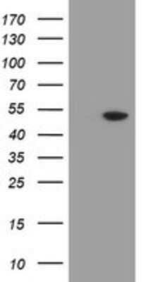Western Blot: MRPS27 Antibody (OTI6E5) - Azide and BSA Free [NBP2-72787] - Analysis of HEK293T cells were transfected with the pCMV6-ENTRY control (Left lane) or pCMV6-ENTRY MRPS27.